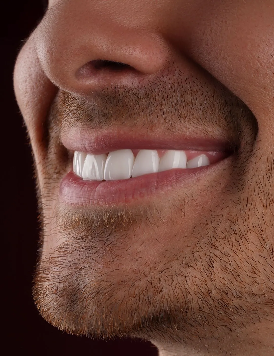 Can You Get Dental Implants Years After Tooth Extraction?