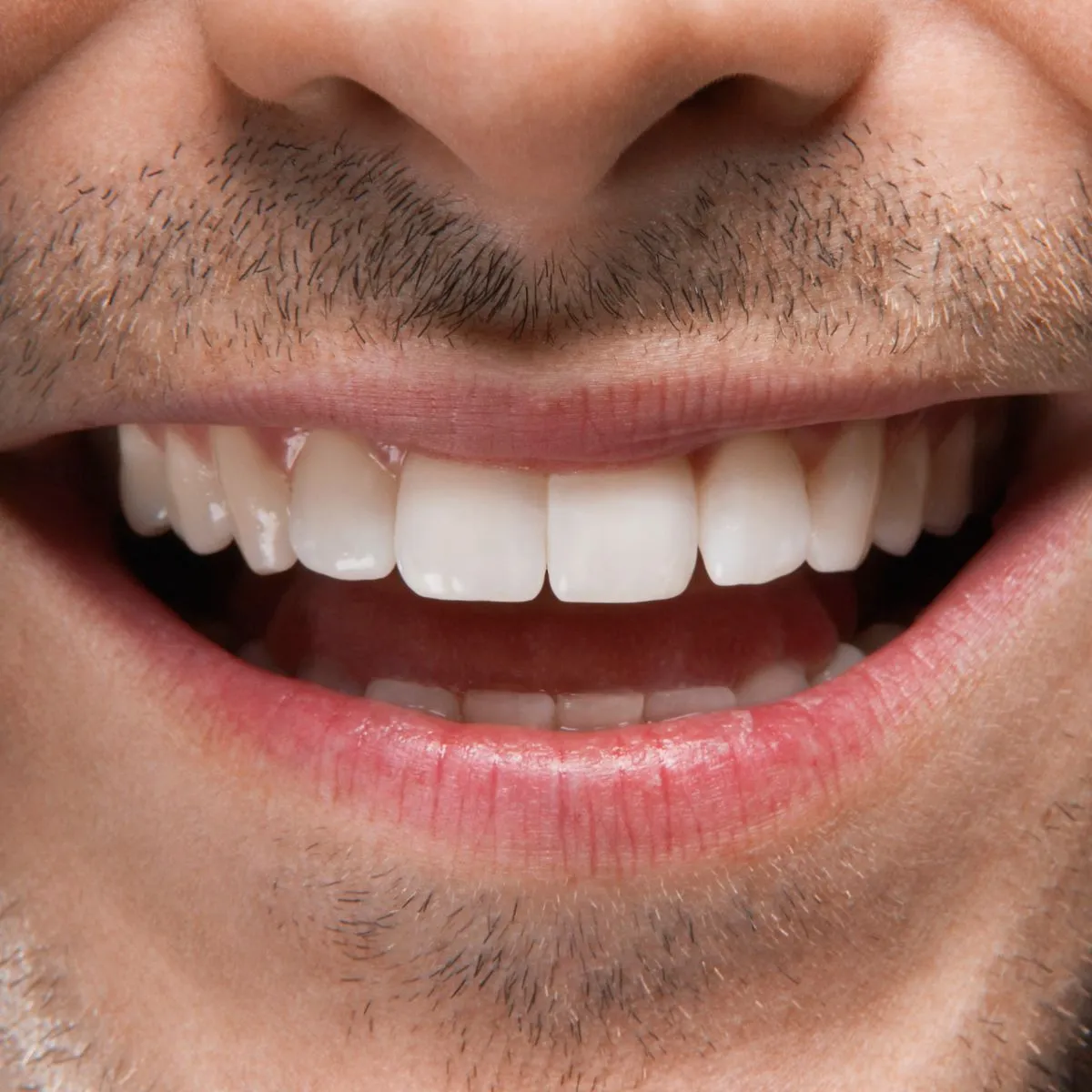 Dental Implants with Low Jawbone Density